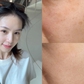 Top 6 serum mờ nám, tàn nhang sau khoảng 4 tuần khiến chị em đều không tin