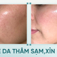 +5 serum mờ nám mảng, nám chân sâu; hiệu quả cả nám lâu năm không xâm lấn