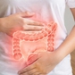 Thói quen giúp giảm nguy cơ ung thư đại tràng