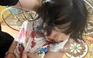 Sức khỏe bé gái ở Hà Giang bị chó tấn công ra sao?