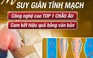 Cơ sở tắm hơi, massage quảng cáo trị suy giãn tĩnh mạch thuộc top 1 châu Âu