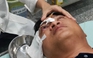 Vận chuyển hóa chất, người đàn ông bị a xít văng trúng gây bỏng mắt