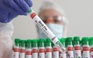 Ca tử vong đầu tiên trên thế giới vì cúm gà H5N2, chưa rõ nguồn lây