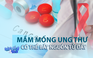 Mầm mống ung thư có thể hình thành khi còn trong bụng mẹ