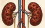 Ngày mới với tin tức sức khỏe: Những triệu chứng cảnh báo thận đang quá tải